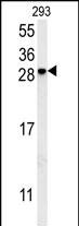 Rabbit Polyclonal Antibody to KCT2