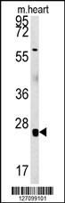Rabbit Polyclonal Antibody to RBM24  (N-term)