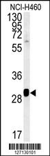 Rabbit Polyclonal Antibody to SC31B  (C-term)