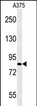 Rabbit Polyclonal Antibody to CPEB4 (N-term)