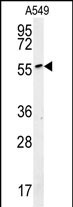 Rabbit Polyclonal Antibody to ALG10B