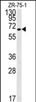 Rabbit Polyclonal Antibody to N4BP3 (N-term)