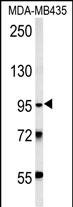 Rabbit Polyclonal Antibody to TRHDE