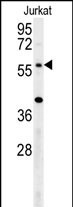 Rabbit Polyclonal Antibody to TRIM50