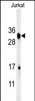 Rabbit Polyclonal Antibody to RSPO4