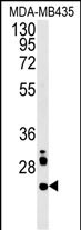Rabbit Polyclonal Antibody to LHPL3  (C-term)