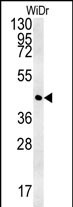 Rabbit Polyclonal Antibody to CCYL1  (N-term)