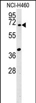 Rabbit Polyclonal Antibody to SYN3