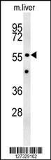 Rabbit Polyclonal Antibody to Z385B  (N-term)