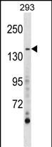 Rabbit Polyclonal Antibody to AEBP1