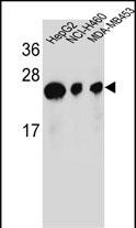 Rabbit Polyclonal Antibody to ATP5H