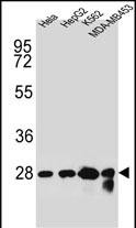 Rabbit Polyclonal Antibody to CHPT1 (N-term)