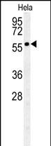 Rabbit Polyclonal Antibody to GALNT4 (N-term)