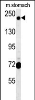 Rabbit Polyclonal Antibody to GCC2