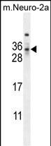 Rabbit Polyclonal Antibody to MAF1