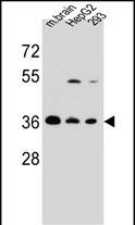 Rabbit Polyclonal Antibody to FBXO2