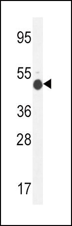 Rabbit Polyclonal Antibody to GCNT2