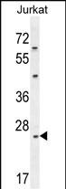 Rabbit Polyclonal Antibody to CLDN22
