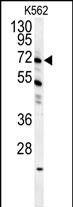 Rabbit Polyclonal Antibody to GAS2L1