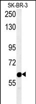 Rabbit Polyclonal Antibody to RADIL