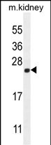 Rabbit Polyclonal Antibody to CALML4