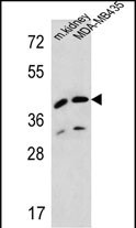 Rabbit Polyclonal Antibody to L2HGDH