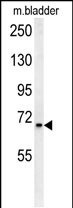 Rabbit Polyclonal Antibody to SLC25A12 (N-Term)