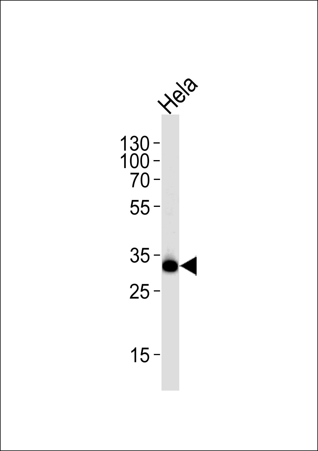 Rabbit Polyclonal Antibody to RPS6 (Ser240/244)