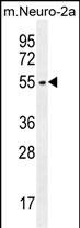 Rabbit Polyclonal Antibody to ZDHHC1 (N-term)