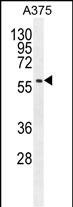 Rabbit Polyclonal Antibody to SPDYE3