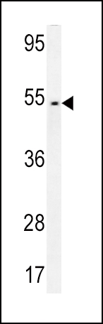 Rabbit Polyclonal Antibody to FAM46A