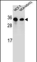 Rabbit Polyclonal Antibody to SAR1B