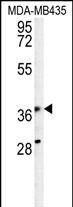 Rabbit Polyclonal Antibody to KPRA (N-term)