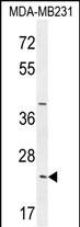 Rabbit Polyclonal Antibody to SYCE2  (N-term)
