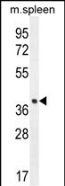 Rabbit Polyclonal Antibody to LHFPL5