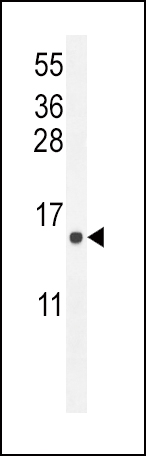 Rabbit Polyclonal Antibody to ATP6V0B