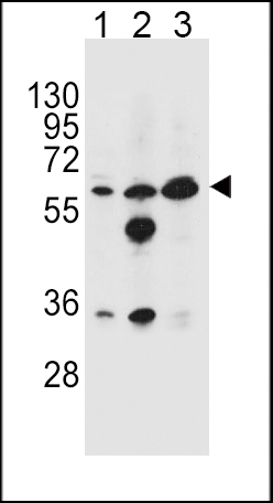 Rabbit Polyclonal Antibody to GATM (N-term)