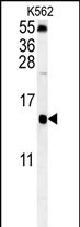 Rabbit Polyclonal Antibody to LSM4