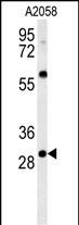Rabbit Polyclonal Antibody to GSTO2