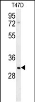Rabbit Polyclonal Antibody to LRRC52