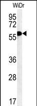 Rabbit Polyclonal Antibody to TANK