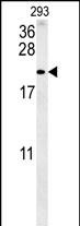 Rabbit Polyclonal Antibody to TAC1