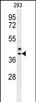 Rabbit Polyclonal Antibody to CAMLG