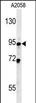 Rabbit Polyclonal Antibody to SMPD4 (N-term)