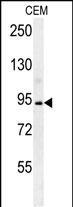 Rabbit Polyclonal Antibody to BCAN