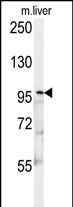 Rabbit Polyclonal Antibody to KIF9