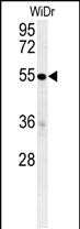 Rabbit Polyclonal Antibody to C4BPA