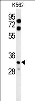 Rabbit Polyclonal Antibody to KCTD15