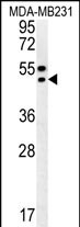 Rabbit Polyclonal Antibody to TRAM2
