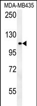 Rabbit Polyclonal Antibody to OTUD4 (N-term)